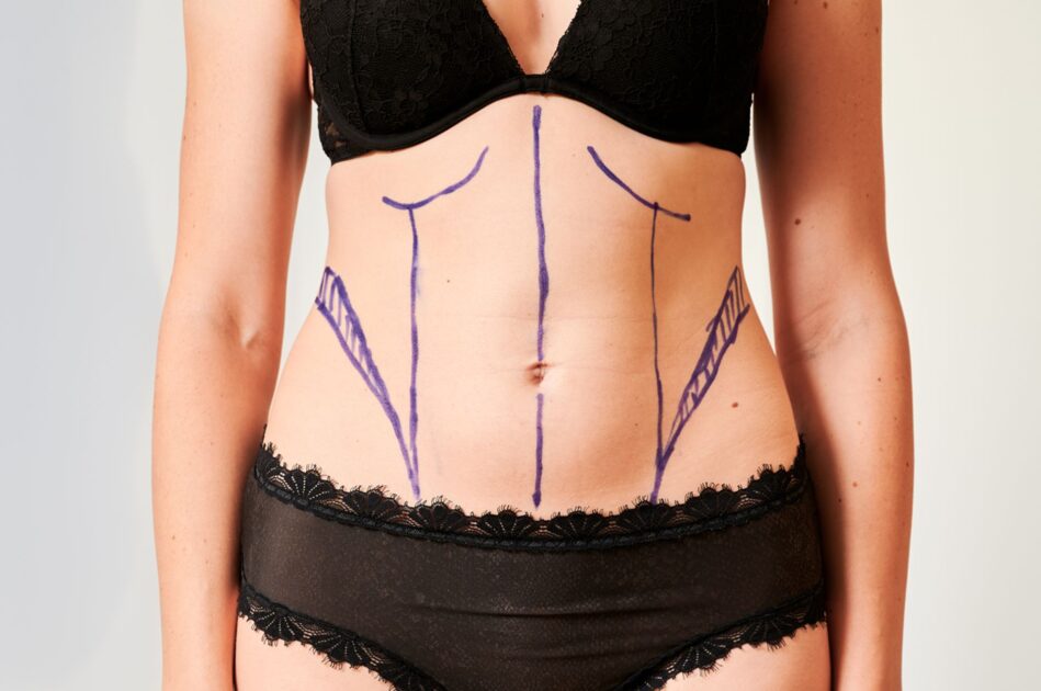 Body