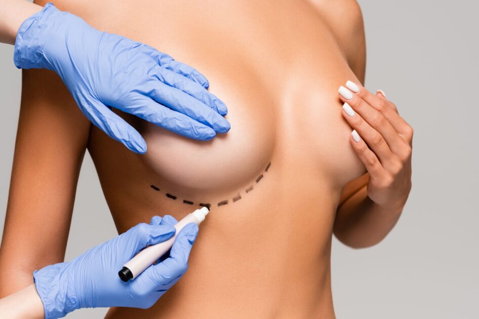 Breast